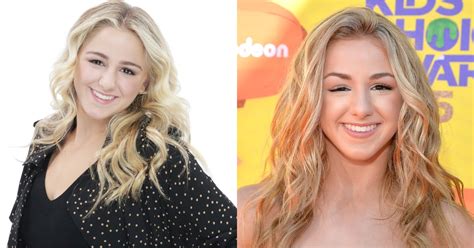 chloe lukasiak eye|Chloe Lukasiak sinus surgery.